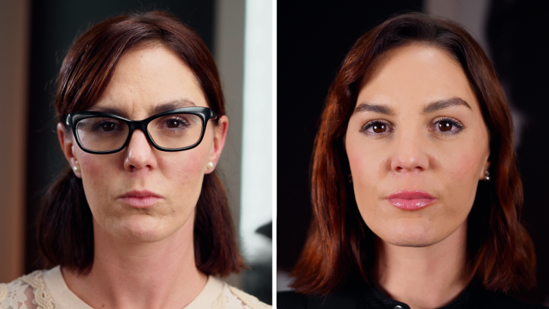 Estetika bez cenzury: Veronika se znovu učí mít ráda své tělo, říká po letech boje s lupénkou